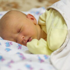 Ictericia neonatal, ¿cuándo debo preocuparme?