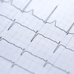 Sudden Cardiac Death: The Impact of Genetics